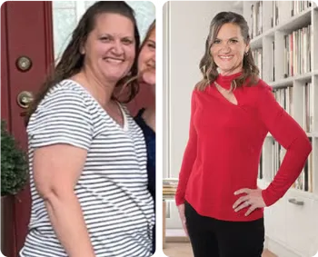 Brenda K. Before and After
