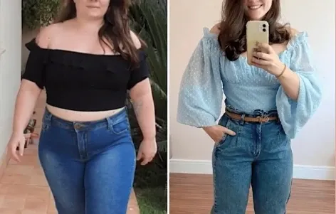 Sarah M. Before and After
