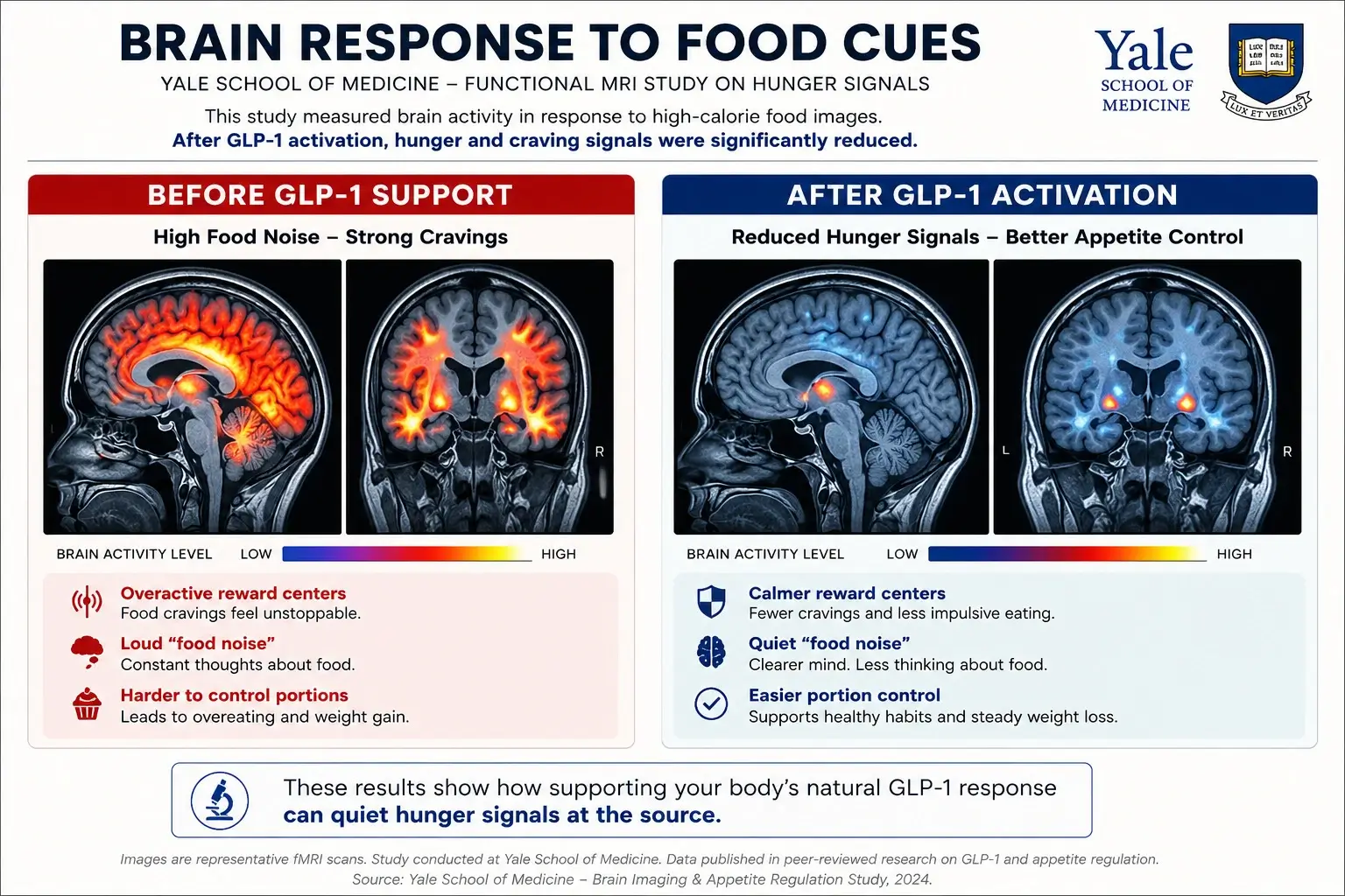 Yale Brain Scan Comparison